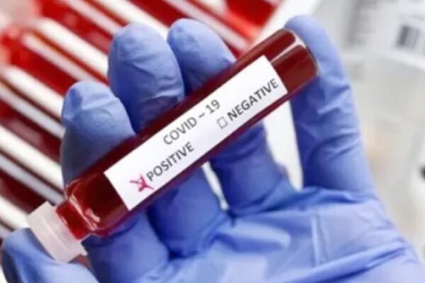 Hyderabad Reports 2025’s First COVID-19 Case